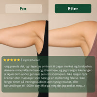 Lymfedrenerende velværedråper™